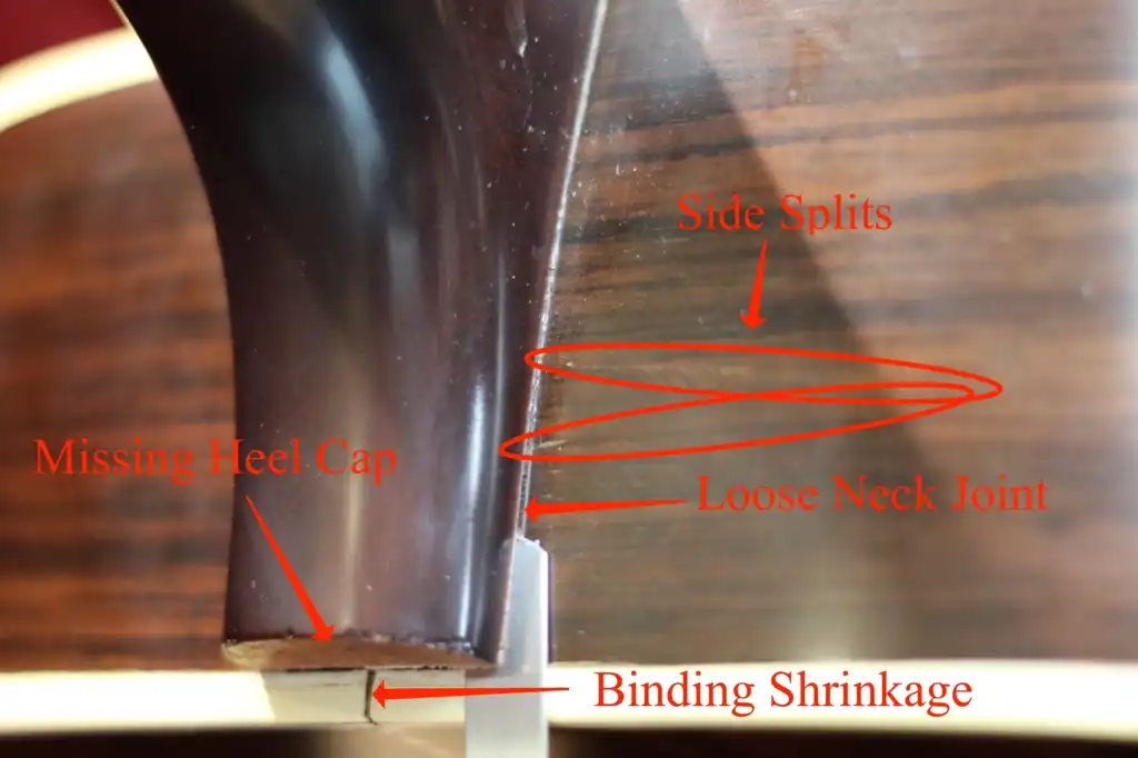 Neck Heel Issues